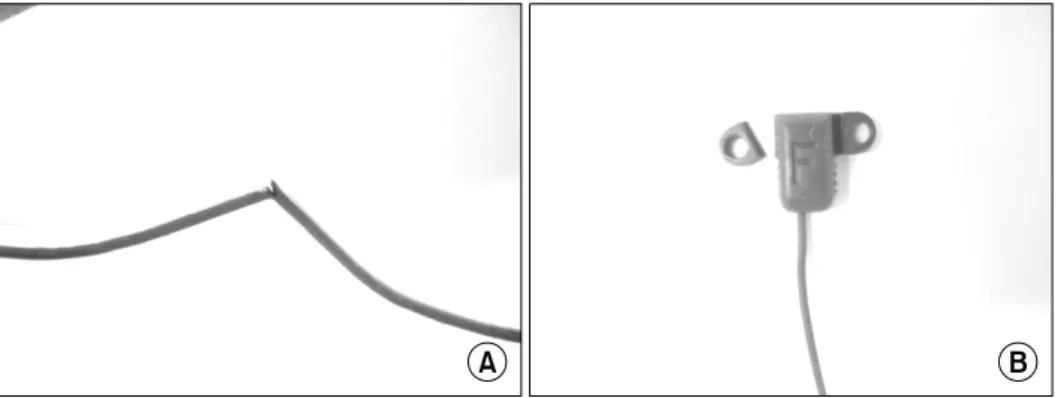 Fig.  2.  The  broken  transmitter  during  the  operative  procedure. 