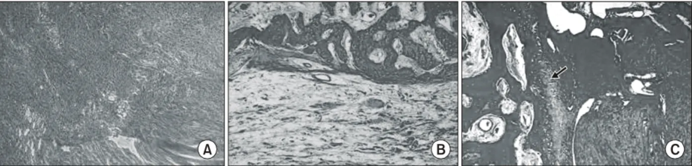 Fig. 1. Microscopic  photographs  of  the  specimen  stained  with  H&amp;E  at  2  weeks  after  surgery  (×100)
