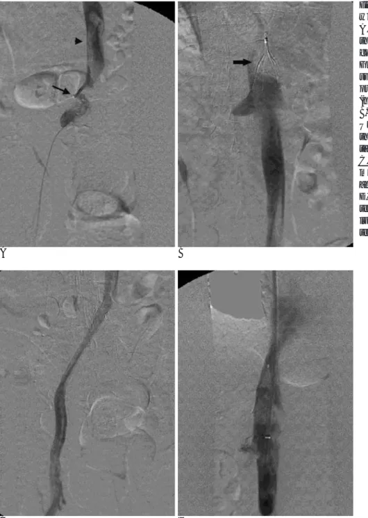 Fig. 4. A 67-year-old man presented with left lower leg edema