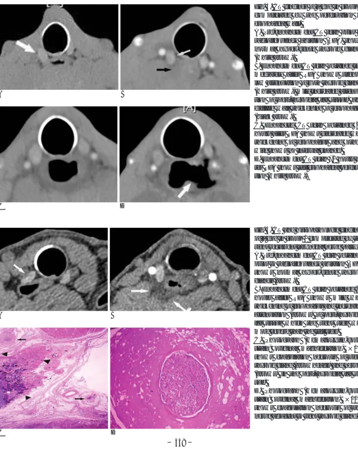 Fig. 4. CT and histopathologic findings of a dog in group 1 complicated by the right recurrent laryngeal nerve palsy