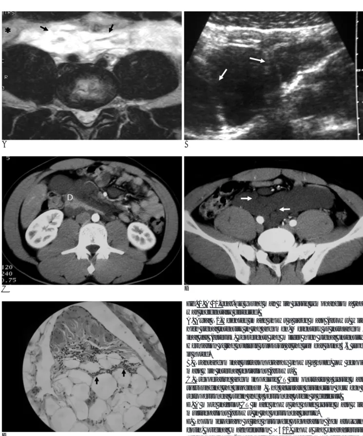 Fig. 1. A 20-year-old young man with cystic lymphangioma that was incidentally detected