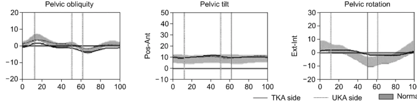 Fig.  1.  Pelvic  kinematics  of  the  UKA  and  TKA  groups.  The  pelvic  motions  of  both  groups  showed  a  normal  sinusoidal  pattern.지면 반발력의 감소) 등이며, 이에 대한 보상 기전은 보행 속도와 단하지 지지기의 감소, 관절 안정성을 증가시키기 위한 슬관절 신전근과 굴곡근의 동시 수축, 밸런스를 유지하기 위한 족배 굴곡과 고관절 굴곡