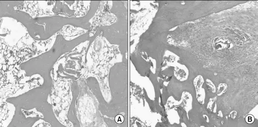 Fig.  3.  Light  microscopic  find- find-ings  of  the  fusion  masses  in  the  allograft  group  (H&amp;E  stain, 