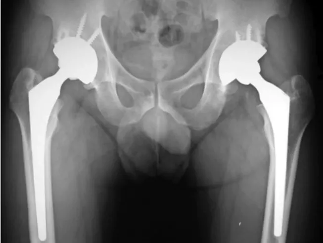 Table  1.  Summary  of  Clinical  and  Radiology  Results