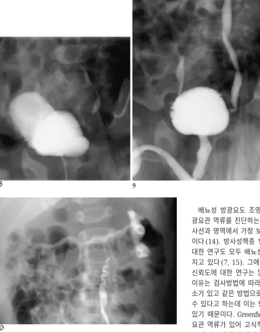 Fig. 1. Cyclic VCUG of a 3-month- 3-month-old boy with upgrade of VUR  dur-ing the second cycle.
