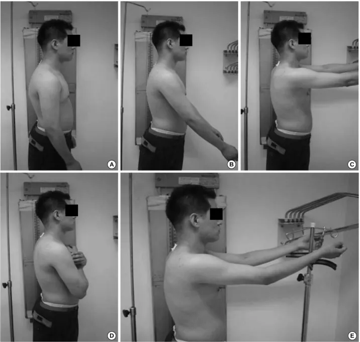 Fig. 2. Five different postures in a relaxed standing position. (A) The photograph illustrates the posture of neutral shoulder flexion which can represent the normal functional position