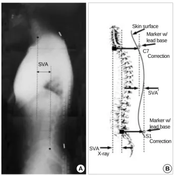 Fig. 3. Five different standing lateral views on radiographs. (A) The radiograph illustrates the posture of neutral shoulder flexion which can represent the normal functional position