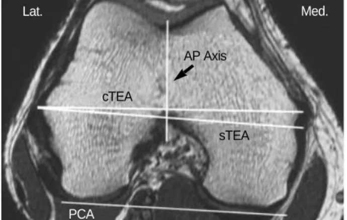 Fig. 2. The change of rotational alignment related to the amount of cartilage erosion