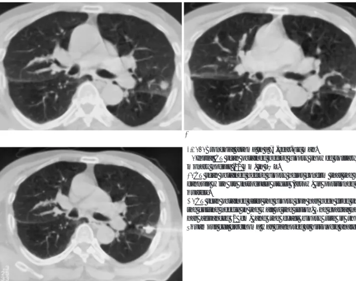 Fig. 1. Bronchial asthma in a 73-year-old man.