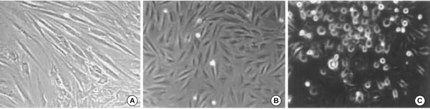 Fig. 1. Morphology of CD34- cells derived from cord blood and mesenchymal stem cells (MSCs) derived from bone marrow, (A) MSCs from bone marrow, (B) MSC-like CD34- cells from human cord blood, (C) multinuclear CD34- cells from human cord blood
