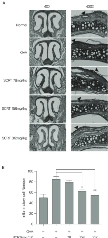 Figure  2.  Effect  of  SCRT  on  inflammatory  cell  infiltration  in  the  AR  nasal  mucosa  tissue