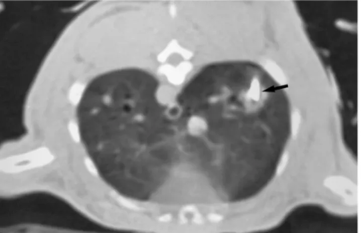 Fig. 1. Complete ablation of a peripherally located lung VX2 tumor in a rabbit after radiofrequency ablation (RFA)