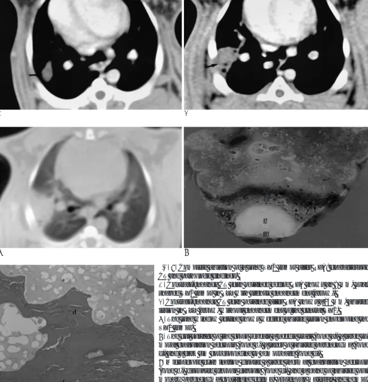 Fig. 3. Complete ablation of a lung VX2 tumor after RFA: characteristic CT and pathologic findings