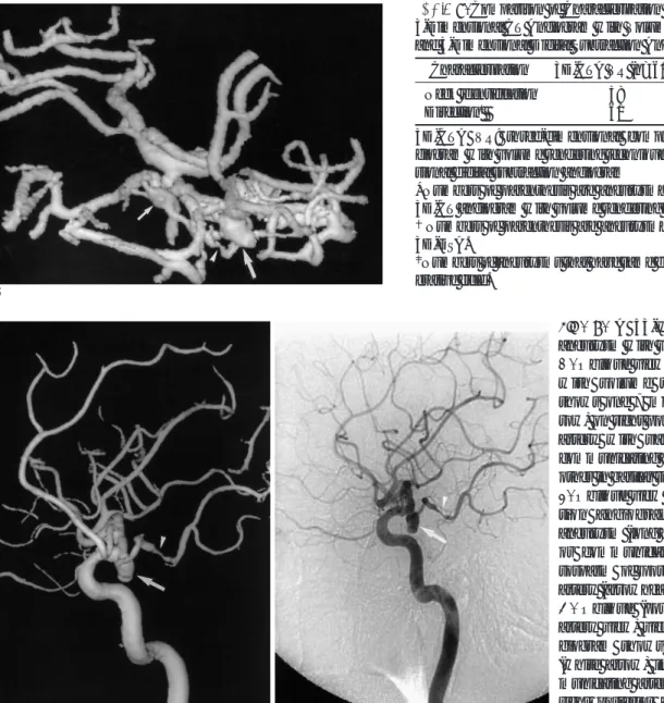 Table 4. Comparison of Characterization of Aneurysms between 3-Dimensional CT Angiogram with Volume Rendering Technique and 3-Dimensional Digital Subtraction Angiogram
