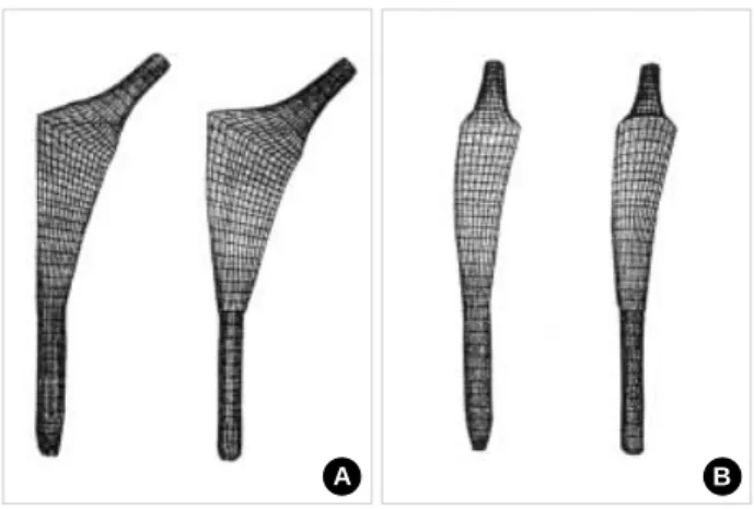 Fig. 1. Finite element models of experimental and reference fe- fe-moral stems. (A) Frontal view of the two fefe-moral stems