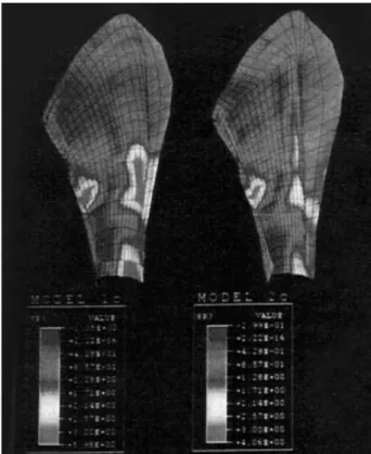 Fig. 11. Bonded interface, anterior cancellous bone, twice max- max-imum shear stresses.