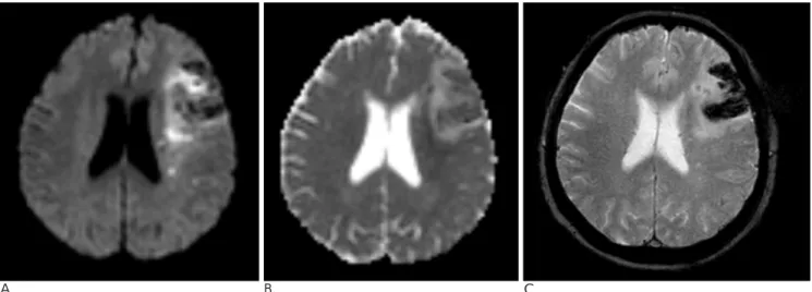 Fig. 2. Follow-up MR images were obtained three days after the initial MR.
