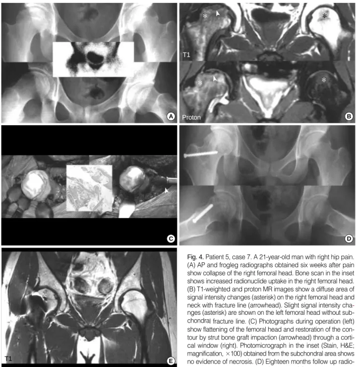 Fig. 4. Patient 5, case 7. A 21-year-old man with right hip pain.
