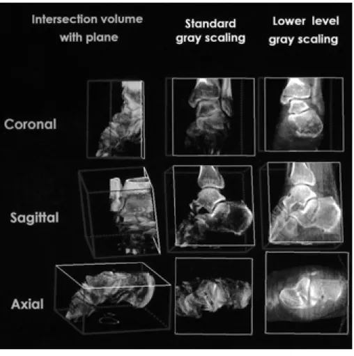 Fig. 1. Postprocessing using multipla- multipla-nar intersection with gray scale  manip-ulation