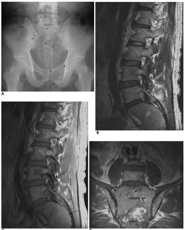 Fig. 8. A 61-year-old man with multiple myeloma.