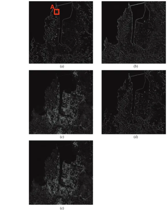 Fig. 3.  HP images: (a) HP-MIR OR , (b) Virtual HP-PAN (MRA), (c) Virtual HP-PAN (CS), (d) Virtual HP-I (MRA), (e) Virtual HP-I (CS).