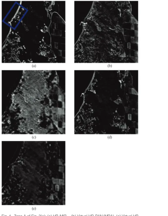 Fig. 4.  Zone A of Fig. 3(a): (a) HP-MIR OR , (b) Virtual HP-PAN (MRA), (c) Virtual HP- HP-PAN (CS), (d) Virtual HP-I (MRA), (e) Virtual HP-I (CS).