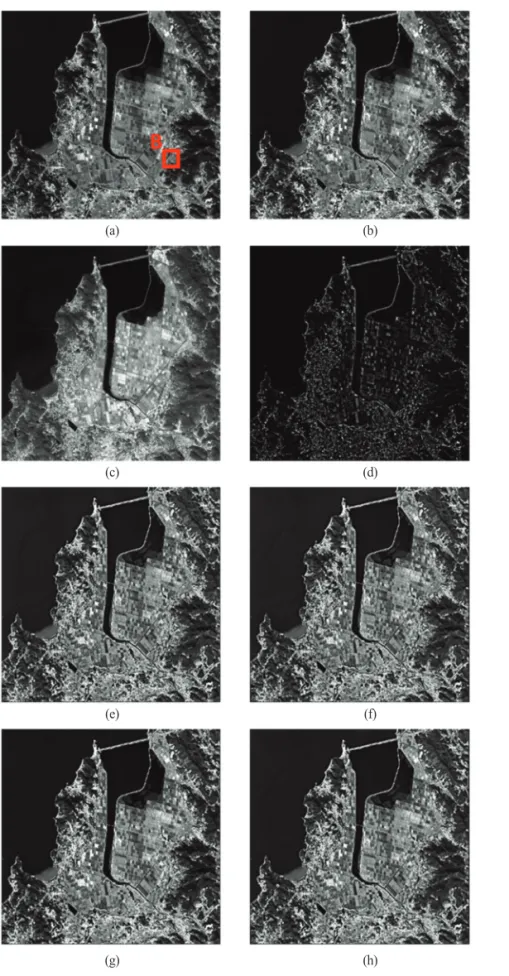 Fig. 5.  Reference and resorting images: (a) MIR OR , (b) MIR rd , (c) I, (d) Virtual-HP I (MRA), (e) std