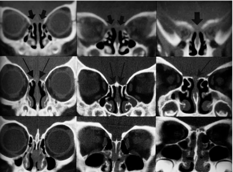 Fig. 1. Postnatal development of the cribriform plate.