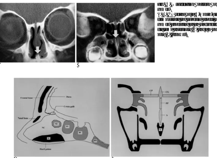 Fig. 4. Ossification pattern of the vomer.