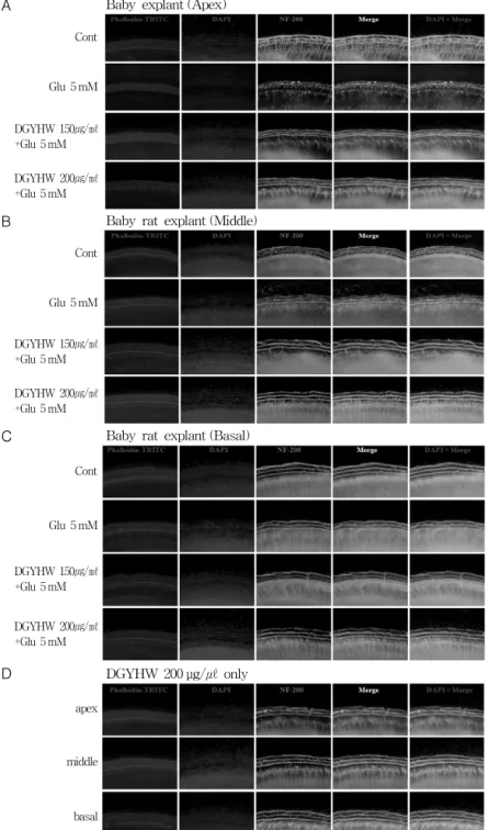 Figure  1.  Protective  effect  of  DGYHW  on  glutamate-induced  sensorineural  cell  death  in  rat  primary  organ  of  Corti  explant.