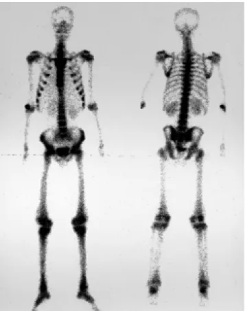 Fig. 5. Photomicrograph of forehead skin shows hyperplastic