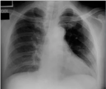 Fig. 1. Changes in radiographic transmission with rotation. X- X-ray beam in A direction traverses a longer path through the  ob-ject, and thus is more attenuated than that in B direction.