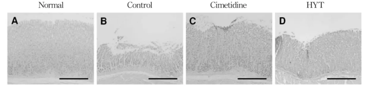 Figure  3.  Light  microscopic  images  of  HCl․EtOH  induced  ulcers  in  rats.  The  rats  of  Control  group  showed  loss  of  mucosa  exposing  the  muscularis  mucosa  (B  arrows)