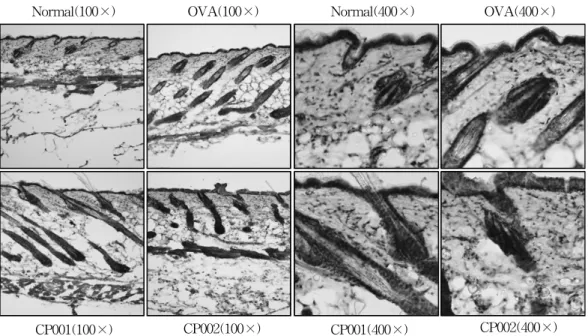 Figure  6.  Comparison  of  CD3  cells(total  T  cells)  of  the  skin  in  Normal,  OVA,  CP001  and  CP002  group