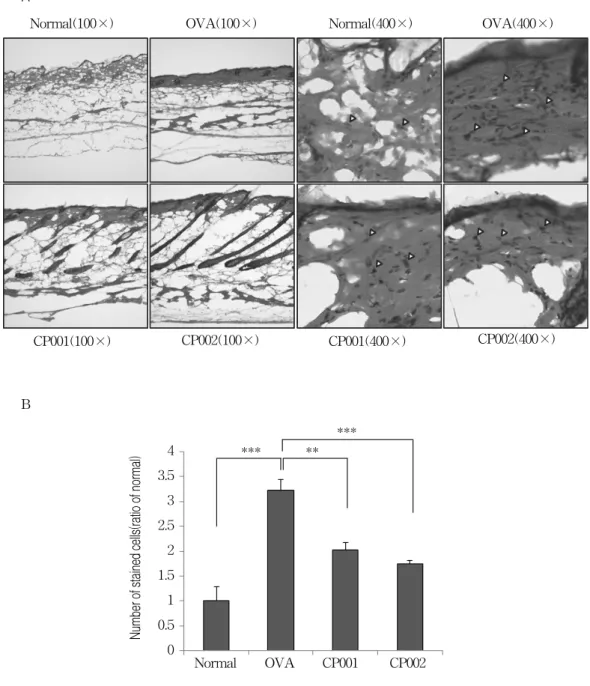Figure  4.  Comparison  of  inflammatory  cells  of  the  skin  from  H&amp;E  stained  sites  in  Normal,  OVA,  CP001  and  CP002  group