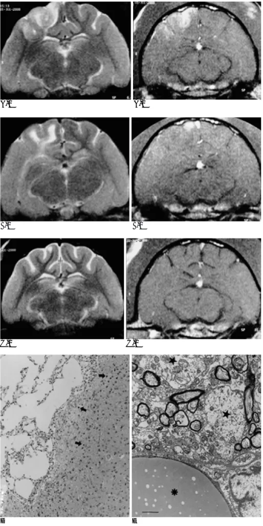 Fig. 1. Serial MRI (A-C), light (D) and electron (E) microscopic findings of cat