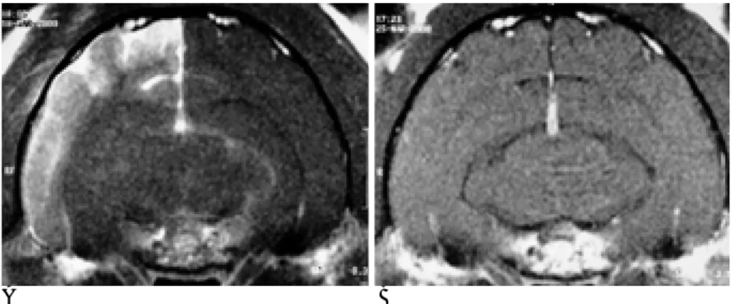 Fig. 3. Gd-T1WI of 2 hours (A) and week 1 (B) and light microscopic  find-ing with hematoxylin-eosin stain (C) of 3 weeks after fat embolization of cat