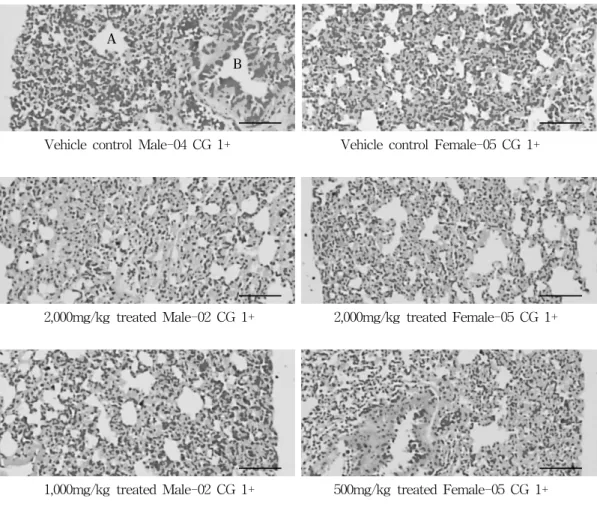 Fig.  4.  Histopathological  changes  detected  on  the  lung. 