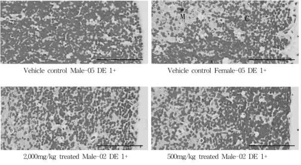 Fig.  5.  Histopathological  changes  detected  on  the  thymus.