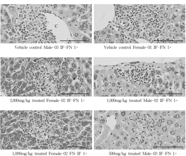 Fig.  6.  Histopathological  changes  detected  on  the  liver. 