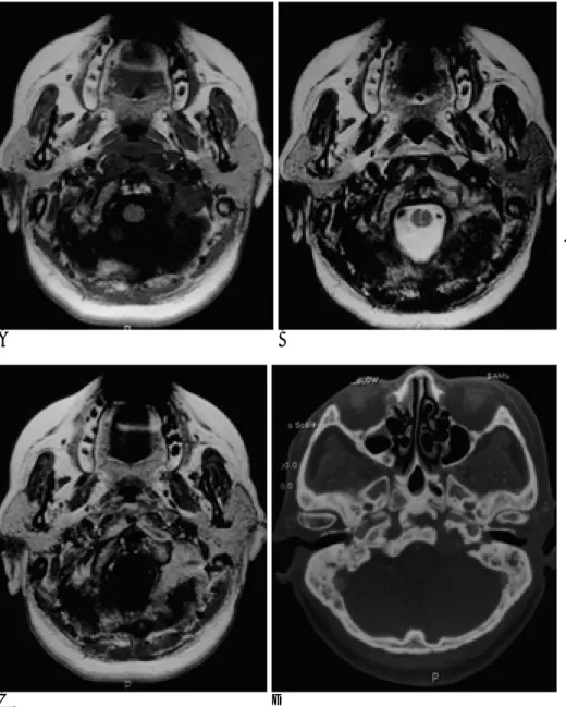 Fig. 1. A 62-year-old woman (case 4).