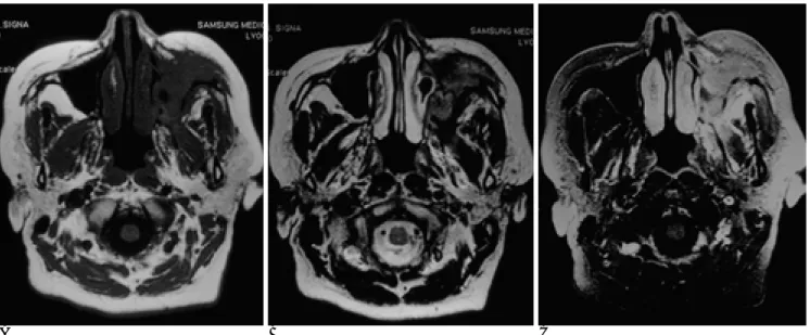 Fig. 2. A 44-year-old woman (case 8).