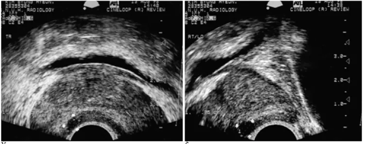Fig. 1. A 77-year-old man with prostate cancer.