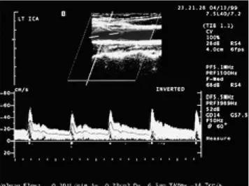 Table 1. Volume Flow measured by 2D Phase-Contrast MR Image and Doppler Ultrasound of Internal Carotid Arteries and Vertebral Arteries in Sixteen Volunteers