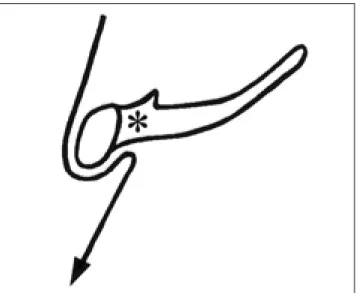 Fig. 5. Diagram of the course of thyroglossal duct at the hyoid level (long curved arrow)
