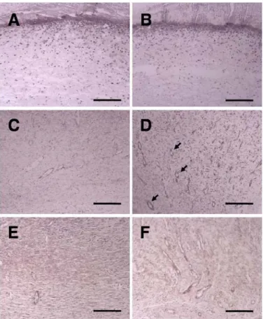 Figure  6.  Immunohistochemical  staining  for  VEGF  of  the  wounded  skins  at  different  time  intervals