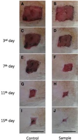 Figure  1.  Changes  of  Wound  Area  on  the  each  day  of  Control(A,  C,  E,  G,  I)  and  Sample(B,  D,  F,  H,  J)  group