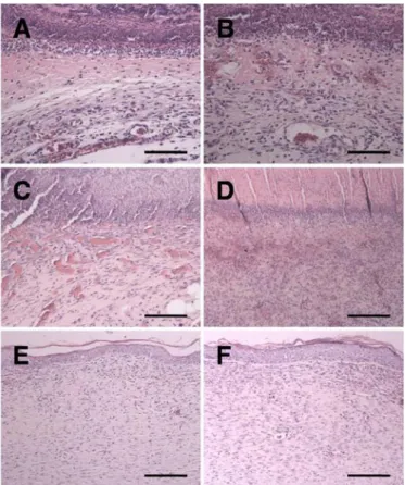 Figure  5.  Hematoxylin  and  eosin  stained  sections  of  the  wounded  skins  at  different  time  intervals