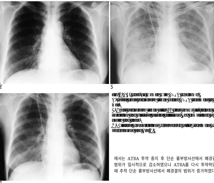 Fig. 2. A 37 year-old woman with ATRA syndrome. 