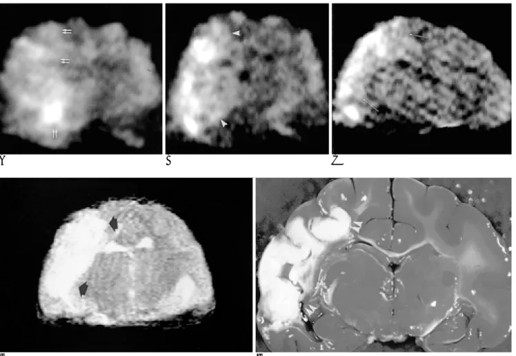 Fig. 2. Diffusion-Weighted MR imaging and brain tissue stained TTC during 120 minutes of temporary middle cerebral artery oc- oc-clusion in cat